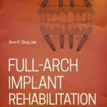 Full-Arch Implant Rehabilitation PDF Free Download