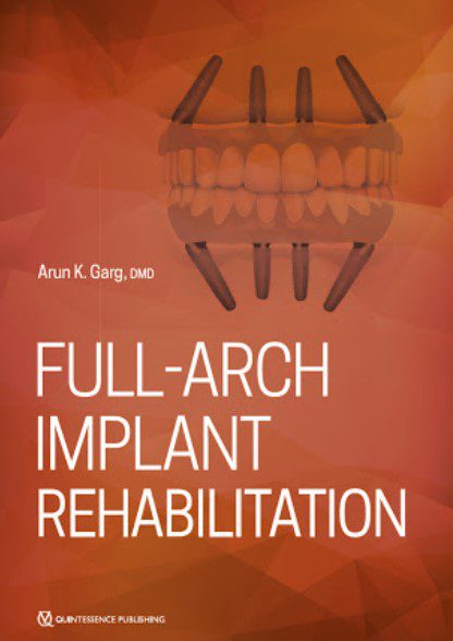 Full-Arch Implant Rehabilitation PDF Free Download