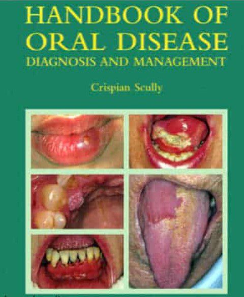 Handbook of Oral Disease Diagnosis PDF Free Download