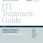 ITI Treatment Guide Volume 1 PDF Free Download