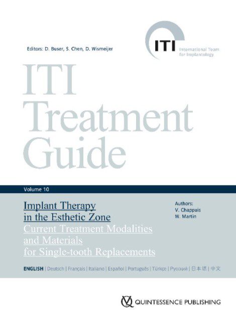 ITI Treatment Guide Volume 10 PDF Free Download