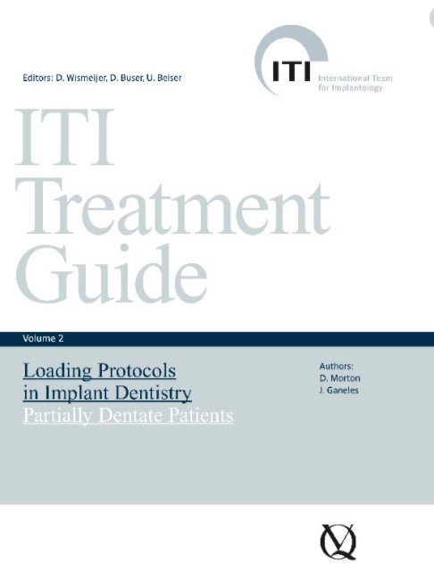 ITI Treatment Guide Volume 2 PDF Free Download