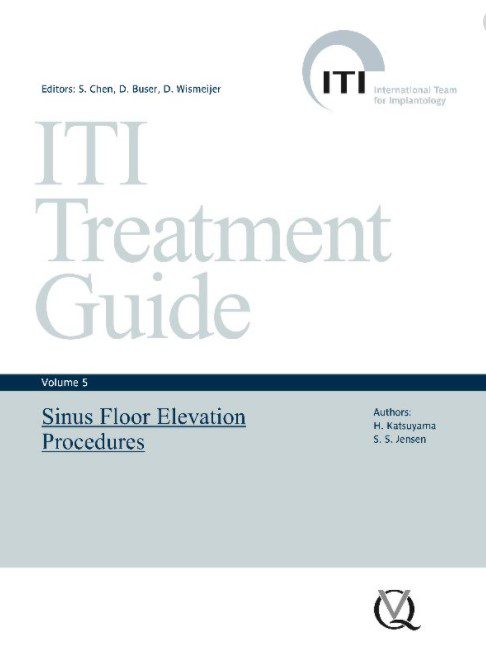 ITI Treatment Guide Volume 5 PDF Free Download