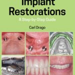 Implant Restorations: A Step-by-Step Guide 4th Edition PDF Free Download