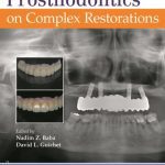 Journal of Prosthodontics on Complex Restorations PDF Free Download