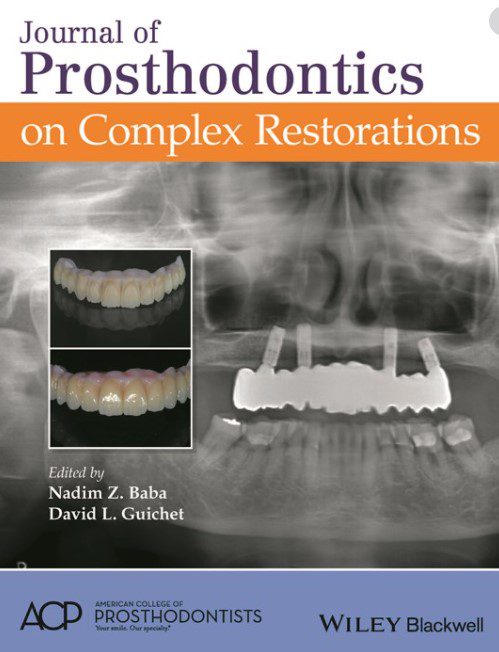 Journal of Prosthodontics on Complex Restorations PDF Free Download