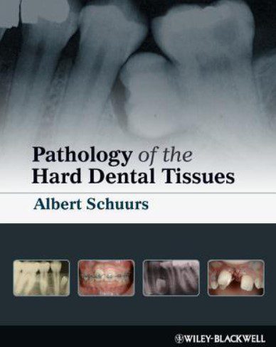 Pathology of the Hard Dental Tissues PDF Free Download