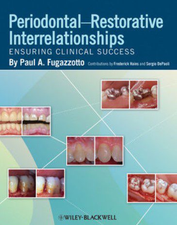 Periodontal-Restorative Interrelationships Ensuring Clinical Success PDF Free Download