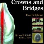 Planning and Making Crowns and Bridges 3rd Edition PDF Free Download