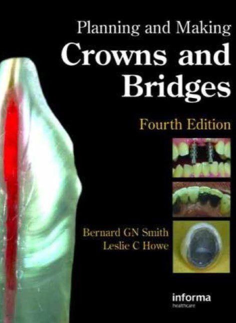 Planning and Making Crowns and Bridges 4th Edition PDF Free Download