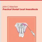 Practical Dental Local Anaesthesia PDF Free Download