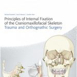 Principles of Internal Fixation of the Craniomaxillofacial Skeleton PDF Free Download