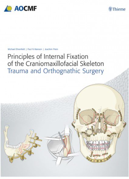 Principles of Internal Fixation of the Craniomaxillofacial Skeleton PDF Free Download