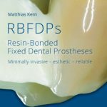 RBFDPs Resin Bonded Fixed Dental Prosthesis PDF Free Download