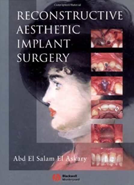 Reconstructive Aesthetic Implant Surgery PDF Free Download