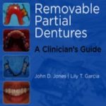 Removable Partial Dentures: A Clinician's Guide PDF Free Download