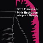 Soft Tissues and Pink Esthetics in Implant Therapy PDF Free Download