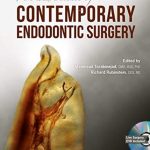 The Art and Science of Contemporary Surgical Endodontics PDF Free Download