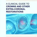 A Clinical Guide to Crown and Other Extra-Coronal Restorations PDF Free Download