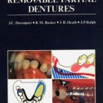A Color Atlas of Removable Partial Denture PDF Free Download