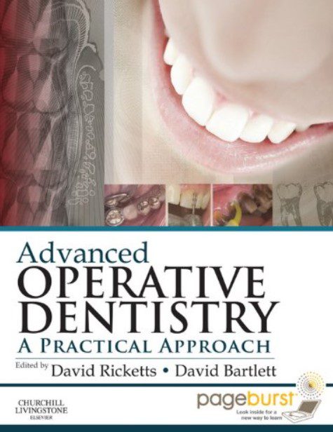 Advanced Operative Dentistry PDF Free Download