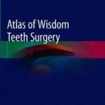 Atlas of Wisdom Teeth Surgery PDF Free Download