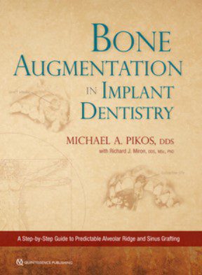 Bone Augmentation in Implant Dentistry PDF Free Download