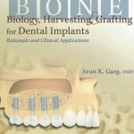 Bone Biology, Harvesting, & Grafting For Dental Implants PDF Free Download