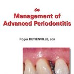 Clinical Success in Management of Advanced Periodontitis PDF Free Download