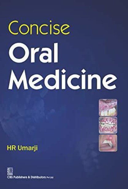 Concise Oral Medicine PDF Free Download