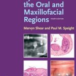 Cysts of the Oral and Maxillofacial Regions 4th Edition PDF Free Download
