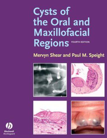 Cysts of the Oral and Maxillofacial Regions 4th Edition PDF Free Download