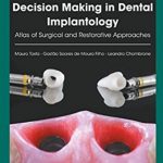 Decision Making in Dental Implantology PDF Free Download