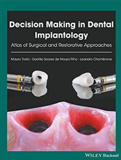 Decision Making in Dental Implantology PDF Free Download