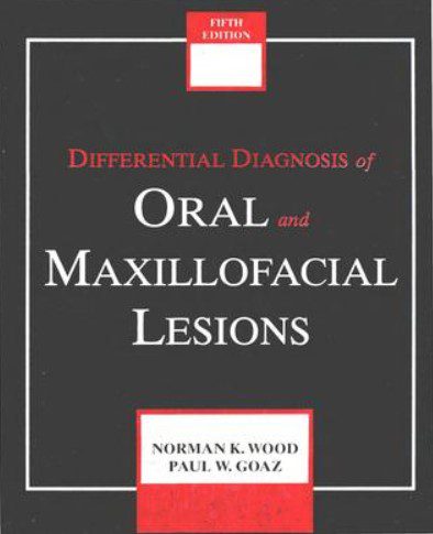 Differential diagnosis of oral lesions 2nd Edition PDF Free Download