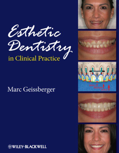 Esthetic Dentistry in Clinical Practice PDF Free Download