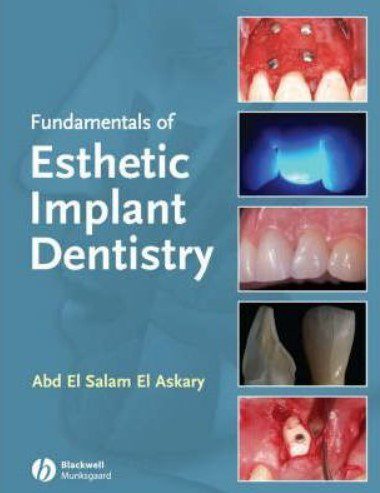 Fundamentals of Esthetic Implant Dentistry PDF Free Download