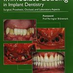 Immediate Loading In Implant Dentistry PDF Free Download