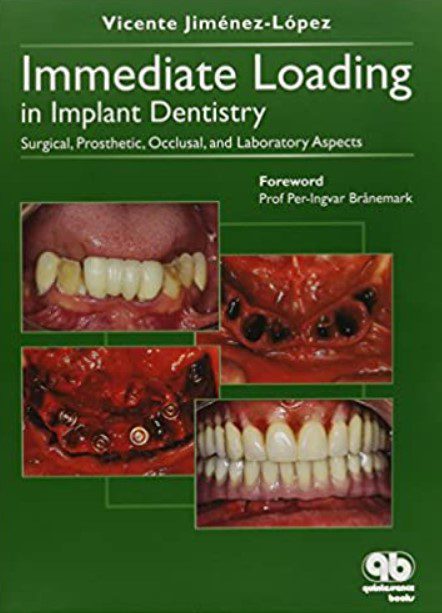 Immediate Loading In Implant Dentistry PDF Free Download