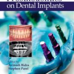 Journal of Prosthodontics on Dental Implants PDF Free Download