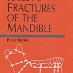 Killey’s Fractures of the Mandible 4th Edition PDF Free Download