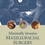 Minimally Invasive Maxillofacial Surgery PDF Free Download