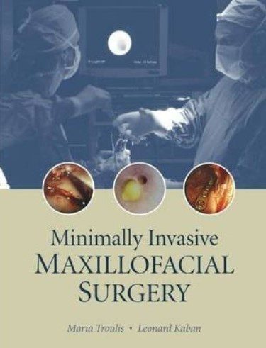 Minimally Invasive Maxillofacial Surgery PDF Free Download