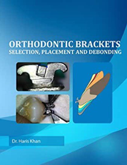 Orthodontic Brackets Selection, Placement and Debonding PDF Free Download