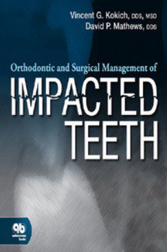 Orthodontic and Surgical Management of Impacted Teeth PDF Free Download