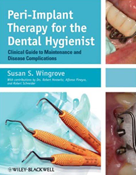 Peri-Implant Therapy for the Dental Hygienist PDF Free Download