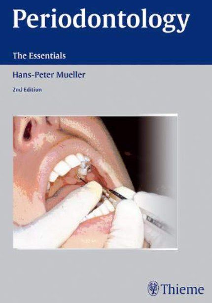 Periodontology The Essentials 2nd Edition PDF Free Download
