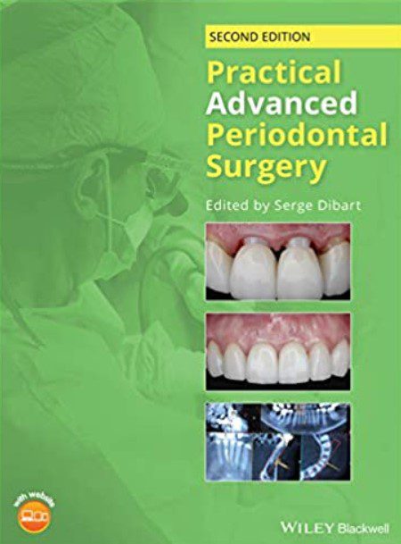 Practical Advanced Periodontal Surgery 2nd Edition PDF Free Download