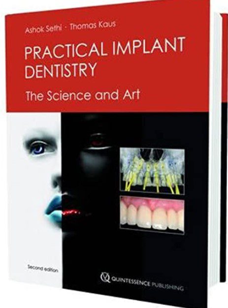 Practical Implant Dentistry The Science and Art 2nd Edition PDF Free Download