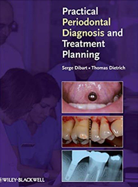Practical Periodontal Diagnosis and Treatment Planning PDF Free Download
